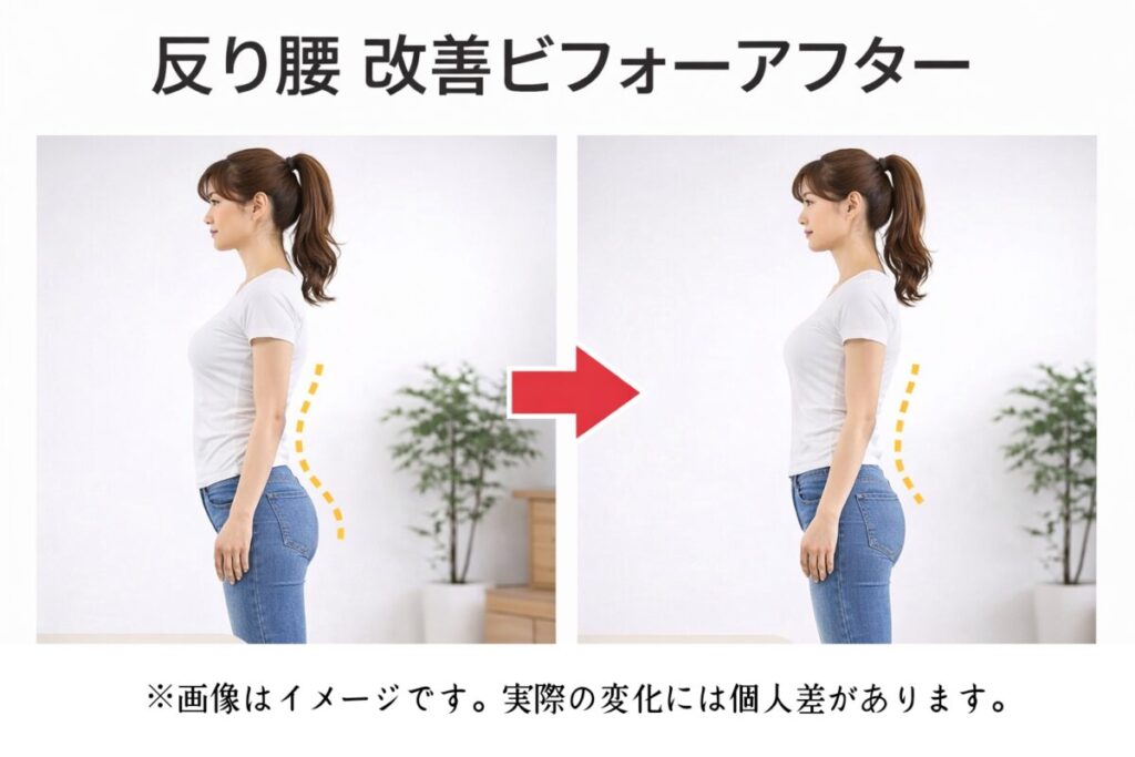 反り腰の改善を表現しているビフォー・アフターの女性のイメージ